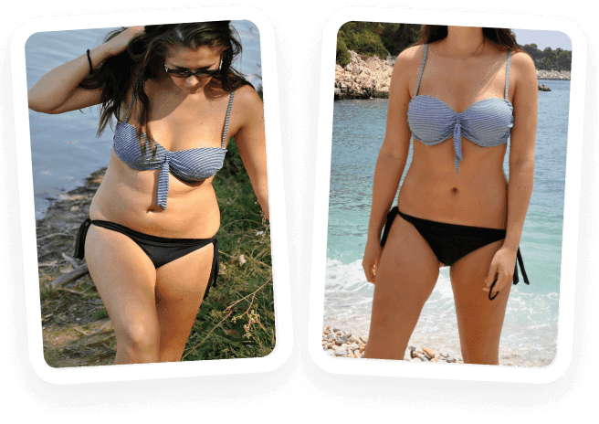 Before After Photo
