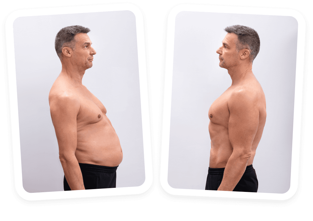Before After Photo